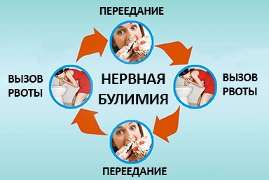 Лечение булимии в Ковылкино